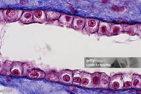 Simple Cuboidal Epithelium Labeled Basement Membrane