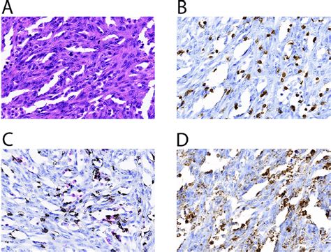 Representative Ihc Stain Of Cd Cd Cd And Pd L A H E Stained