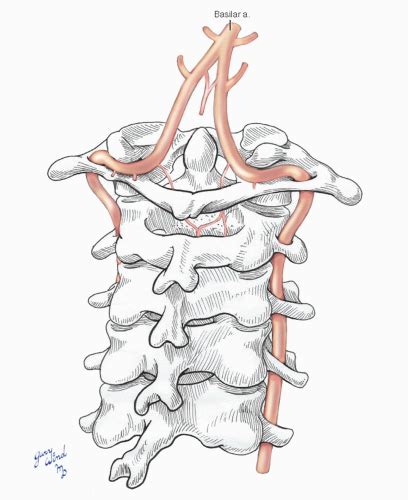 Vertebral Arteries Basicmedical Key