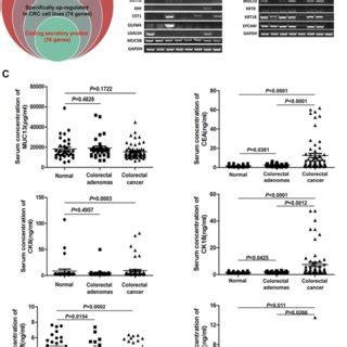 The Expression Of Cea Ck And Ck In Tumor Tissues And Cancer Cell