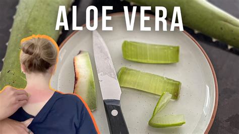 How To Use Aloe Vera Plant For Sunburn Relief Youtube