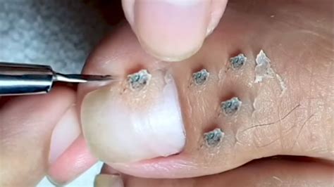 How To Repair Nails Easy 371 Youtube