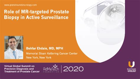 Role Of Mr Targeted Prostate Biopsy In Active Surveillance Video