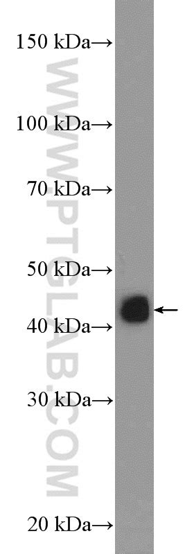 Hla Class I Abc Antibody 15240 1 Ap Proteintech 武汉三鹰生物技术有限公司