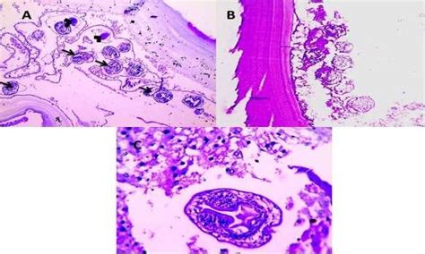 Aandb Histopathology Of Hydatid Cyst A Broad Capsule Containing Download Scientific Diagram