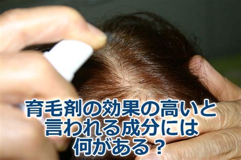 育毛剤の効果の高いと言われる成分には何がある？ エミュみたいに髪の毛ボーボー！