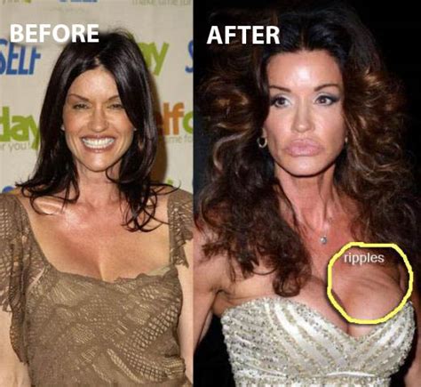 Janice Dickinson Plastic Surgery Before And After Celeb Surgery