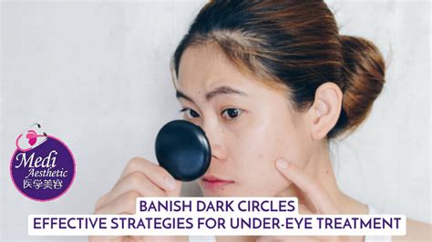 Banish Dark Circles Effective Strategies For Under Eye Treatment
