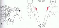 Supraspinatus Flashcards Quizlet