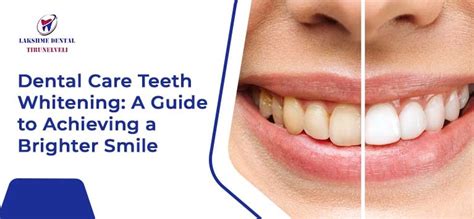 Dental Care Teeth Whitening A Guide To Achieving A Brighter Smile