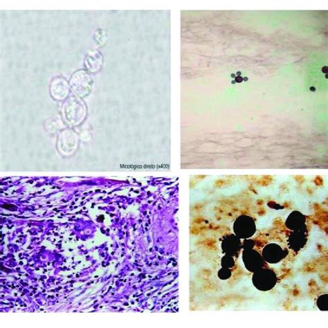 Confocal Microscopy Of P Brasiliensis Yeast Cells Comparatively