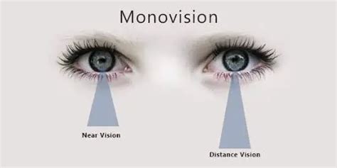 Monovision Correction Ophthalmology Clinic In Dubai Drhc