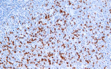 Pd Antibody Rabbit Monoclonal Antibody Mab Ihc Buy Now