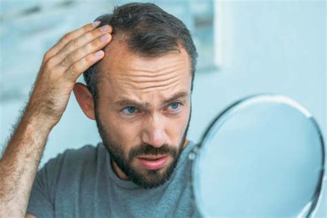 Unveiling 7 Potent Insights Into Hair Loss Causes Symptoms And