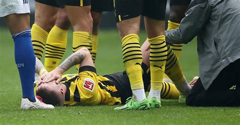 Football Marco Reus Injury Puts World Cup Participation In Doubt