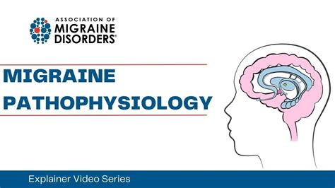 Migraine Pathophysiology Chapter 3 Migraine Explainer Video Series Youtube