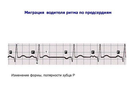 Алгоритмы диагностики в общей врачебной практике, семейной медицине ...