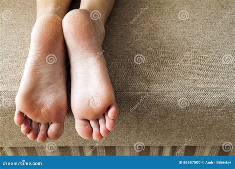 Seque La Piel Agrietada De Los Pies De La Mujer En Cama Tratamiento Del