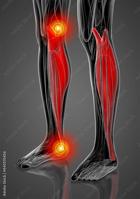 Medical Illustration Of The Gastrocnemius Stock Illustration Adobe Stock