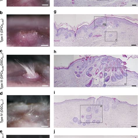 Hair Inducing Ability Of Dermal Papilla Cells At Passage 60 DPCsp 60