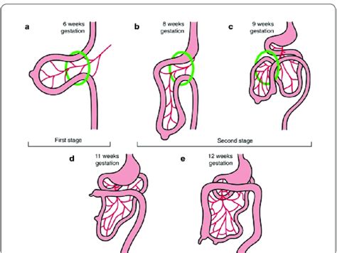 Stages Of Embryonic Rotation Of The Gut Used With Permission From Download Scientific Diagram