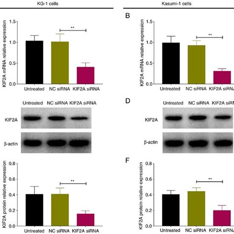 Kif2a Sirna Was Successfully Transfected In Aml Cells Kif2a Mrna