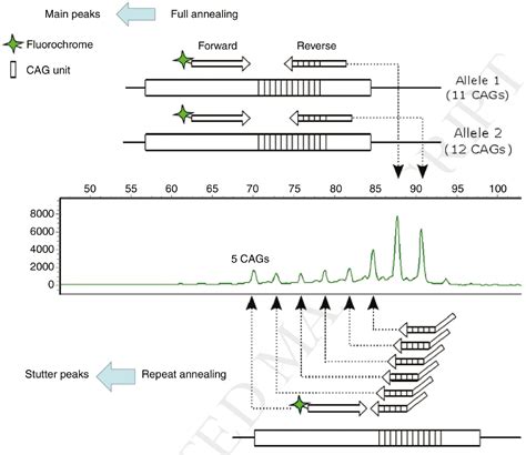 Capillary Electrophoresis Based On Nucleic Acid Analysis For Diagnosing Inherited Diseases