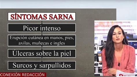 Alerta Por El Aumento De Sarna Cómo Se Contagia Y Qué Síntomas Provoca Cuatro Al Día