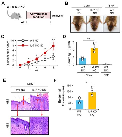 IJMS Free Full Text IL 7 Deficiency Exacerbates Atopic Dermatitis