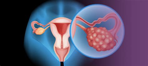 Reserva ovariana o que é Clínica Reproduce