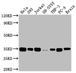 Anti Homo Sapiens Human ATF5 Recombinant Monoclonal Antibody Cusabio