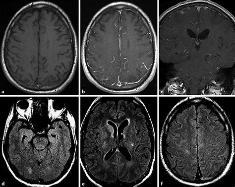 Mri With Or Without Contrast Hot Sex Picture