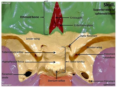 Multi Colored Skull Superior View Of Ethmoid And Sphenoid Bones With