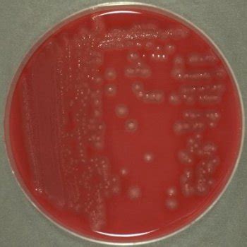Clostridium perfringens