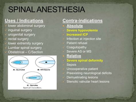 Regional anesthesia | PPT