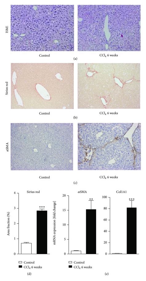 Hepatic Stellate Cell Activation In Vivo And Isolation Of Hepatic Download Scientific Diagram