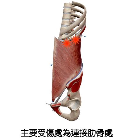 投球腹肌拉傷？透過max Scherzer認識腹內斜肌拉傷 棒球 運動視界 Sports Vision