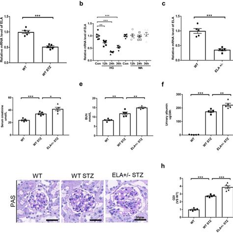 Ela Deficiency Exacerbates Diabetic Glomerular Injury In Vivo A Ela