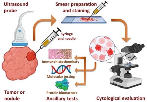 Introductory Chapter Fine Needle Aspiration Cytopathology As A