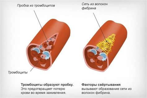 Повышенные тромбоциты в крови: причины, симптомы, лечение, осложнения