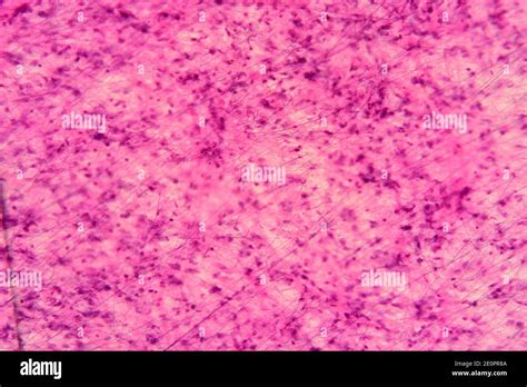 Kent Tetraedro Alergia Fibroblastos Microscopio Optico Puerto Marítimo Mineral Silbar