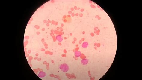 Atlas Of Blood Cells In Hematology Introduction List Of Content