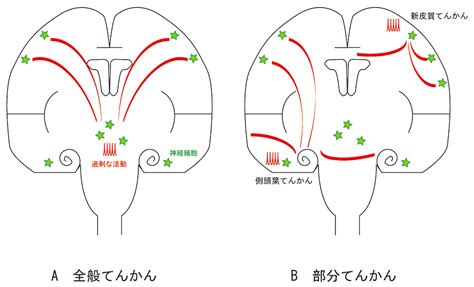 てんかん 脳神経外科 京都大学医学部附属病院