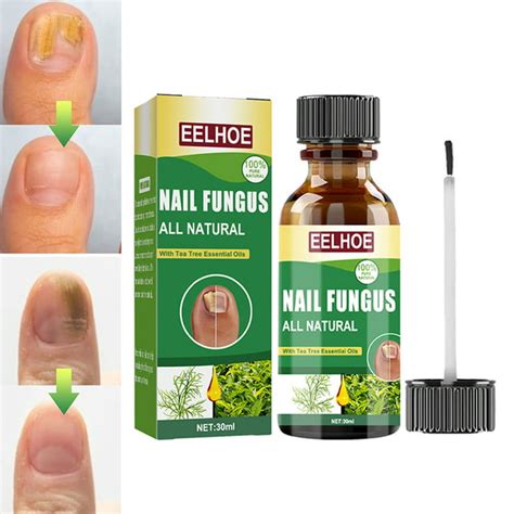 Toenail Fungus Treatment Effective Nail Fungus Treatment For Toenail