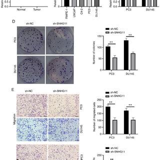 SNHG11 Knockdown Inhibits Pca Cell Proliferation Migration And