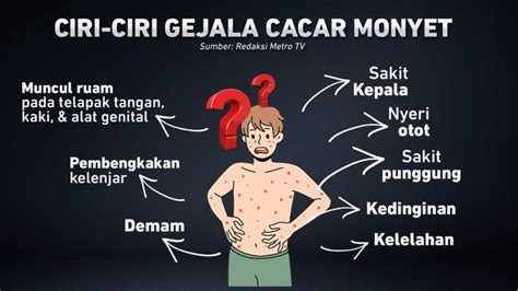 Ayo Waspadai Penularan Cacar Monyet Di Indonesia