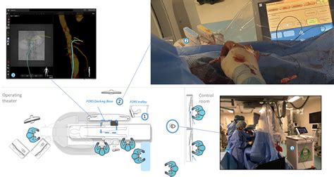 Endovascular Navigation With Fiber Optic Realshape Technology Journal