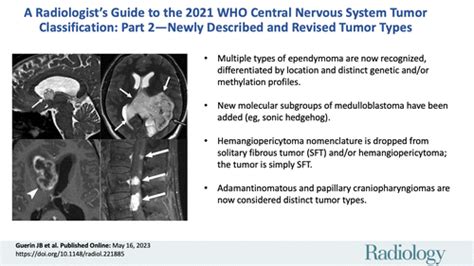 A Radiologists Guide To The 2021 WHO Central Nervous System Tumor