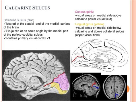 EXAMS AND ME : Calcarine Sulcus