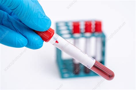 Test Tubes With Blood Samples Stock Image F Science Photo